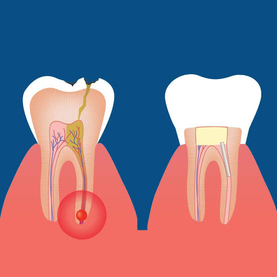 V CARE MULTI SPECIALITY DENTAL CLINIC AMBALAVAYAL