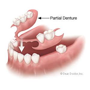 V CARE MULTI SPECIALITY DENTAL CLINIC AMBALAVAYAL