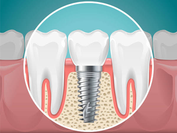 V CARE MULTI SPECIALITY DENTAL CLINIC AMBALAVAYAL