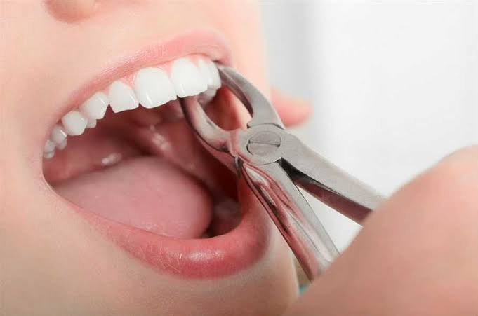 V CARE MULTI SPECIALITY DENTAL CLINIC AMBALAVAYAL